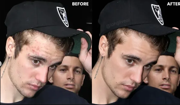 Professional skin retouching with premium sharpness, advanced imperfection correction; eliminates pimples, acne, blackheads, temporary